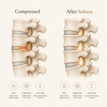 Solvera™ Deep Relief Back Therapy System